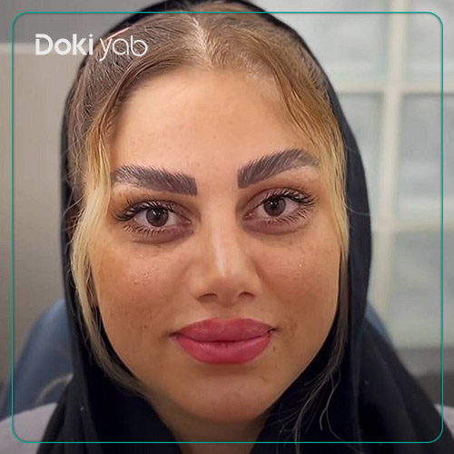 نمونه عمل بینی نیمه فانتزی دکتر لیلا شریفی