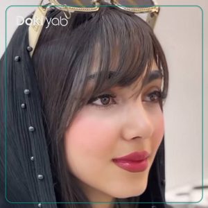 نمونه کار بینی دکتر حسین کرم نژاد به سبک طبیعی