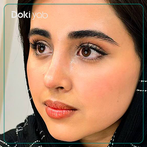 نمونه کار جراحی بینی طبیعی دکتر حامد پوستچی