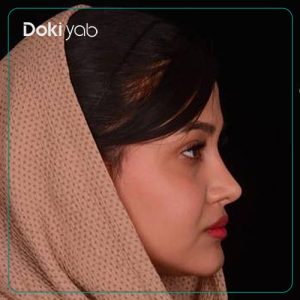 نمونه کار عمل بینی دکتر حامد پوستچی به سبک طبیعی