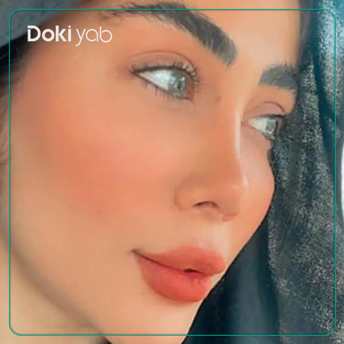 نمونه کار جراح زیبایی بینی به سبک فانتزی دکتر بهروز گندمی در شیراز