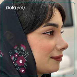 نمونه کار جراحی بینی به سبک فانتزی توسط دکتر حسین کرم نژاد