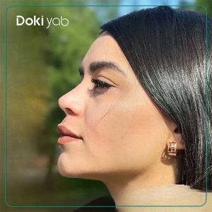 نمونه کار جراحی بینی به سبک نیمه فانتزی دکتر دنیا کرمی در شیراز