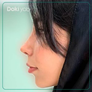 نمونه کار جراحی بینی دکتر آمیتیس نوذری جراح بینی در شیراز