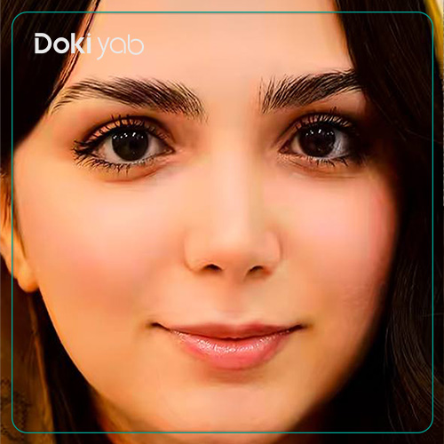 نمونه کار جراحی بینی زنانه به سبک طبیعی توسط دکتر حامد پوستچی