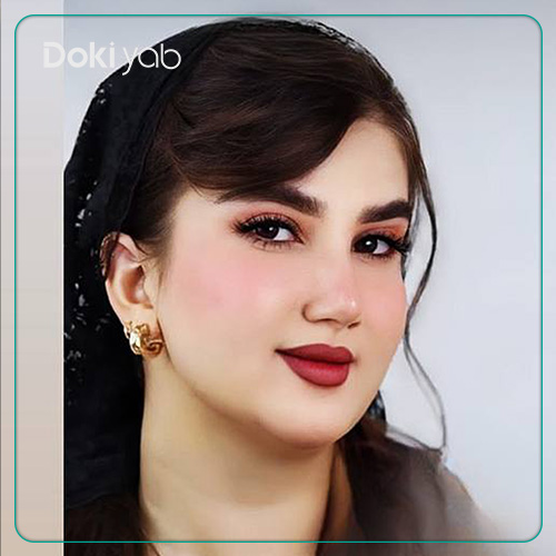 نمونه کار جراحی بینی دکتر خسرو خسروی جراح بینی در شیراز