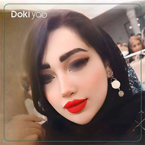 نمونه کار جراحی بینی دکتر دنیا کرمی در شیراز