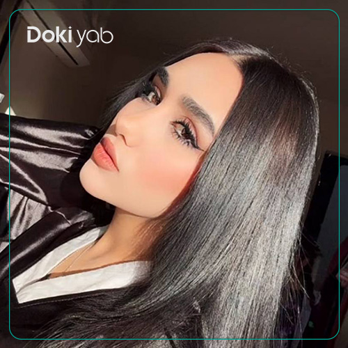نمونه کار جراحی بینی نیمه فانتزی دکتر شهریار شاهمرادی