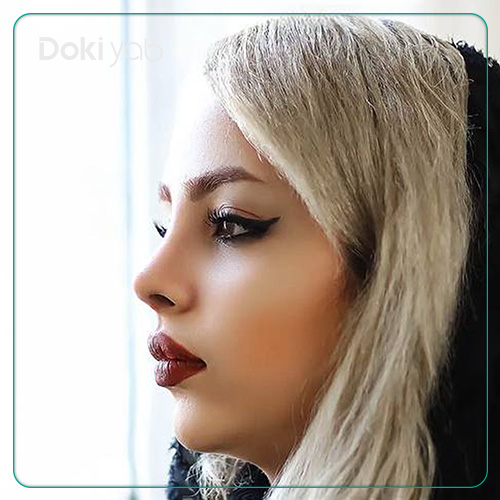 نمونه کار جراحی بینی دکتر مسیح طالع به سبک نیمه فانتزی در شیراز