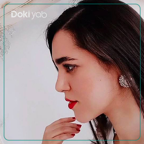نمونه کار جراحی بینی طبیعی دکتر محمد مهدی ده بزرگی جراح بینی در تهران
