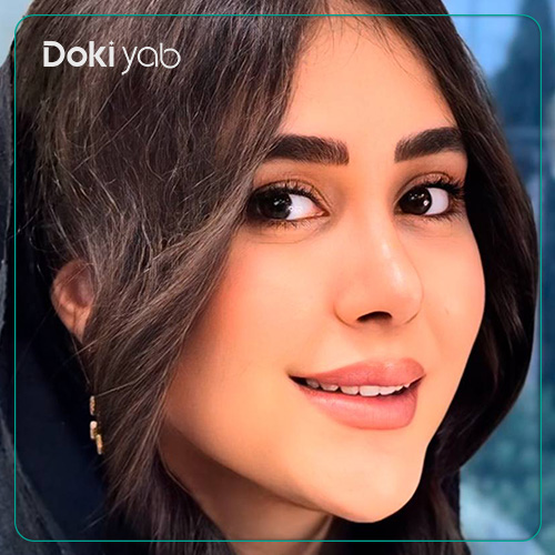 نمونه کار جراحی بینی نیمه فانتزی دکتر آمیتیس نوذری جراح بینی در شیراز