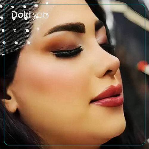 نمونه کار جراحی بینی نیمه فانتزی دکتر زهرا خسروی در شیراز