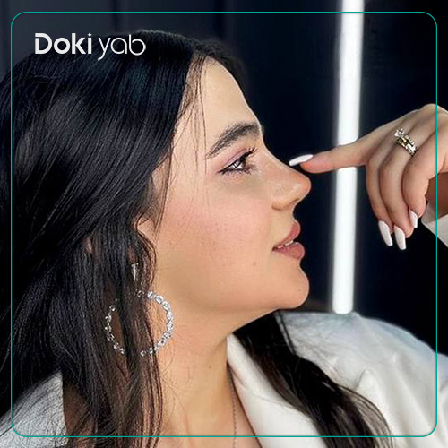 نمونه کار جراحی بینی نیمه فانتزی دکتر لطفعلی نوروزی جراح بینی در شیراز