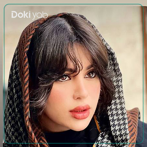نمونه کار رینوپلاستی دکتر خسرو خسروی جراح بینی در شیراز