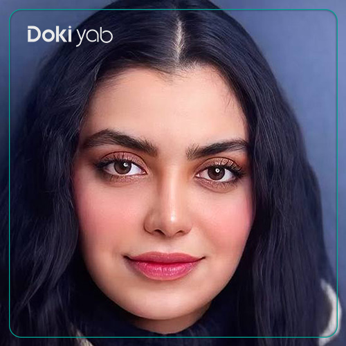 نمونه کار رینوپلاستی دکتر لطفعلی نوروزی جراح بینی در شیراز