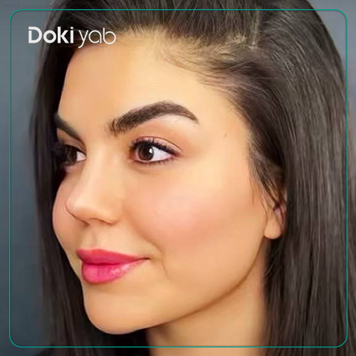 نمونه کار رینوپلاستی نیمه فانتزی دکتر لطفعلی نوروزی جراح بینی در شیراز