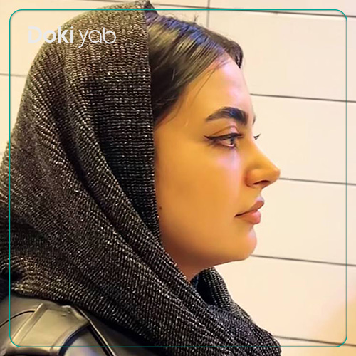 نمونه کار عمل بینی به سبک نیمه فانتزی توسط دکتر مجتبی قائدی در شیراز