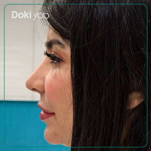نمونه کار عمل بینی دکتر علیرضا مصباحی به سبک طبیعی