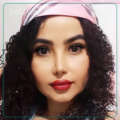 نمونه کار عمل بینی دکتر ونون آصفی به سبک نیمه فانتزی در شیراز