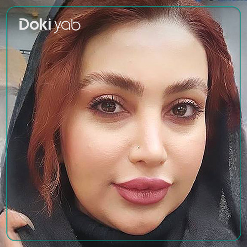 نمونه کار عمل بینی سبک نچرال توسط دکتر محمد مهدی ده بزرگی