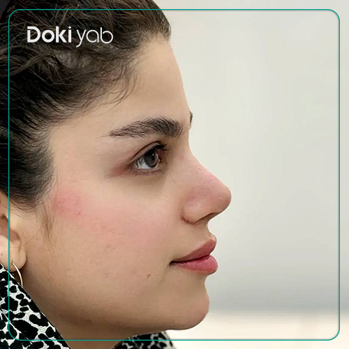 نمونه کار عمل بینی طبیعی دکتر حسین کرم نژاد