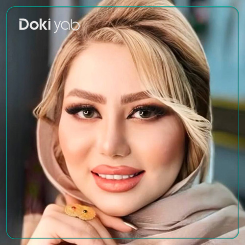نمونه کار عمل بینی طبیعی دکتر خسرو خسروی جراح بینی در شیراز