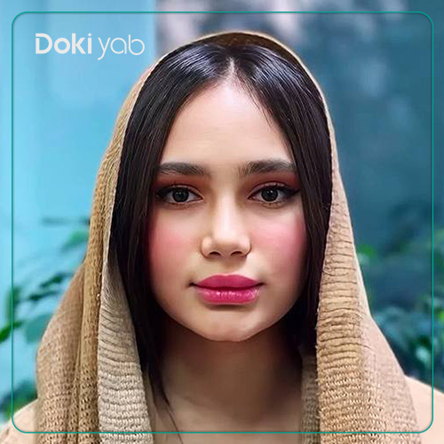 نمونه کار عمل بینی طبیعی دکتر لطفعلی نوروزی جراح بینی در شیراز