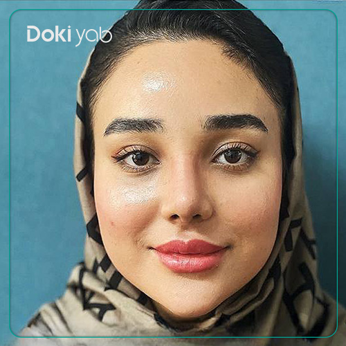 نمونه کار عمل بینی طبیعی دکتر نگار جعفری