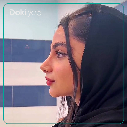 نمونه کار عمل بینی نیمه فانتزی دکتر مجتبی قائدی جراح بینی در شیراز