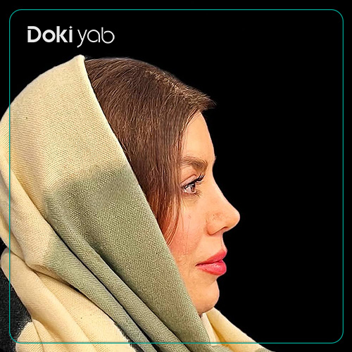 نمونه کار عمل بینی نیمه فانتزی دکتر مجتبی قائدی در شیراز