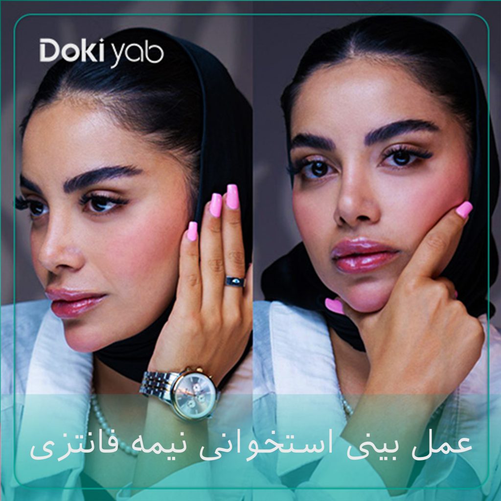 عمل بینی استخوانی نیمه فانتزی