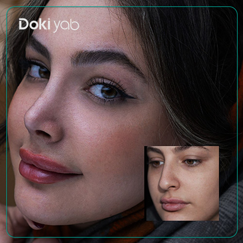 نمونه عمل بینی بدون عوارض جانبی در دکی یاب