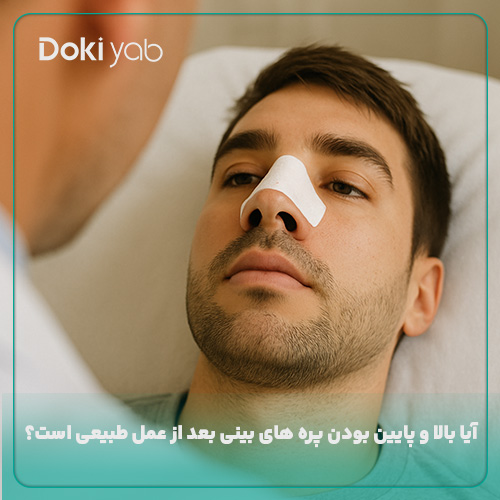 بررسی اینکه آیا بالا و پایین بودن پره های بینی بعد از عمل طبیعی است یا نه در مجله دکی یاب