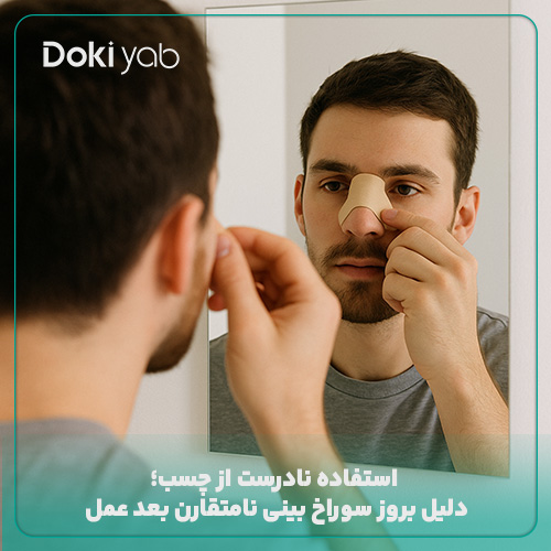 چسب زدن نادرست باعث عدم تقارن سوراخ‌های بینی می‌شود