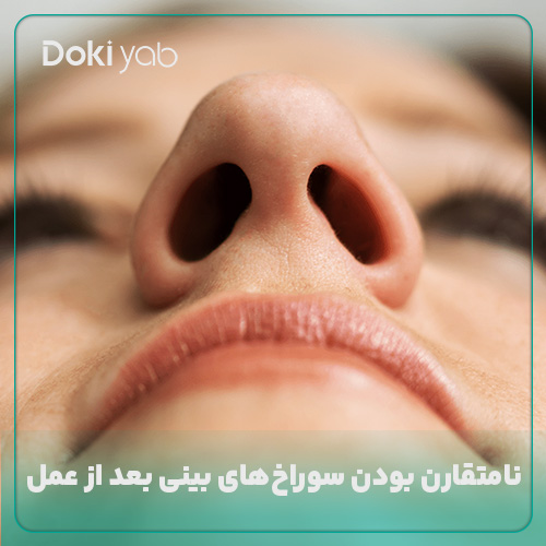 بررسی علت نامتقارن بودن بینی بعد از عمل در مجله دکی یاب