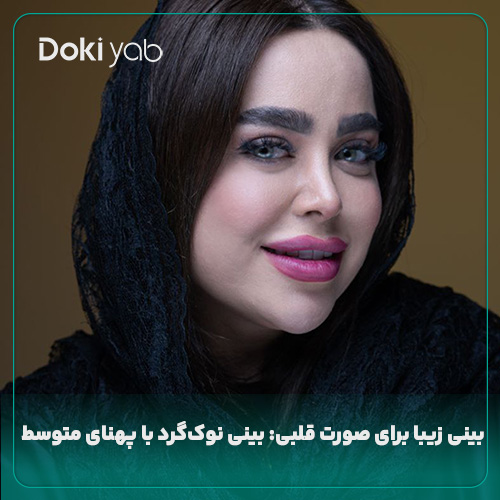 بینی زیبا برای صورت قلبی؛ نمونه جراحی بینی با دکی یاب