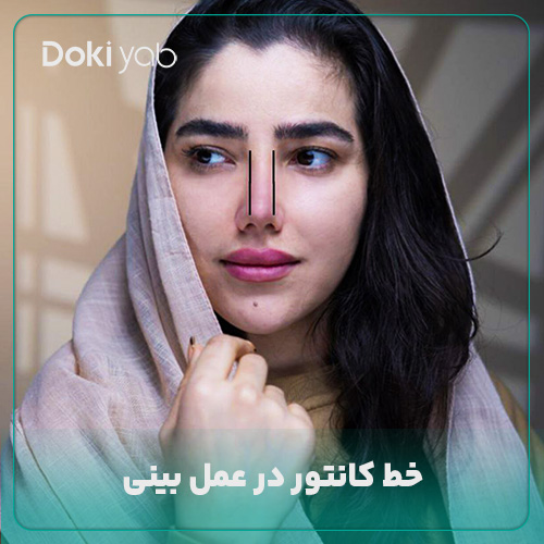 بررسی خط کانتور در عمل بینی در مجله دکی یاب