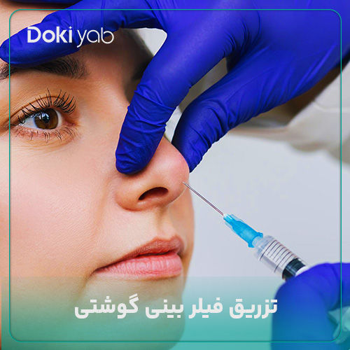 تزریق فیلر بینی گوشتی؛ مجله دکی یاب
