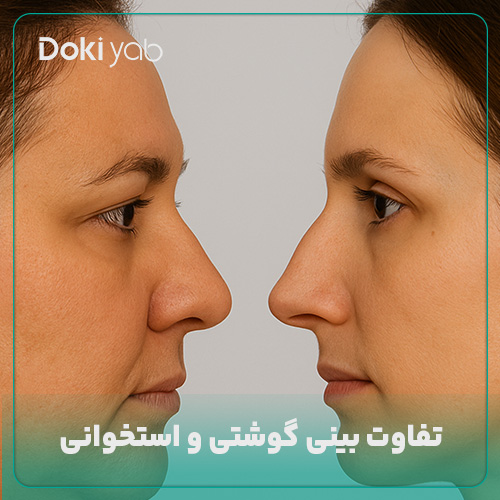 تفاوت بینی گوشتی و استخوانی در مجله دکی یاب
