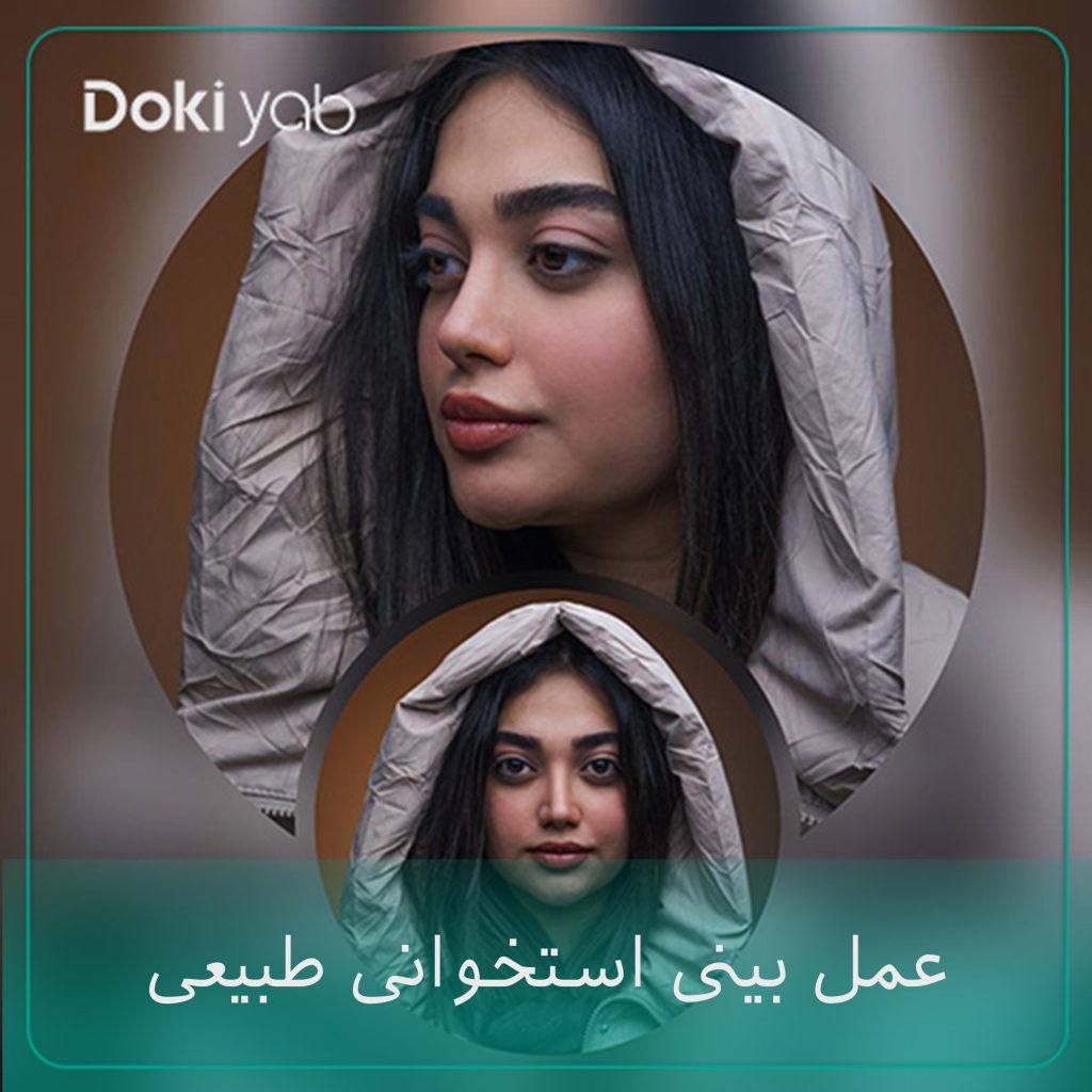 عمل بینی استخوانی طبیعی