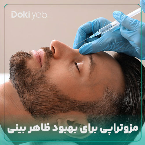 مزوتراپی بینی روشی برای بهتر شدن ظاهر بینی