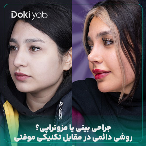 بررسی تفاوت‌های مزوتراپی بینی و جراحی؛ نمونه بینی عمل‌شده با مشاوره دکی یاب