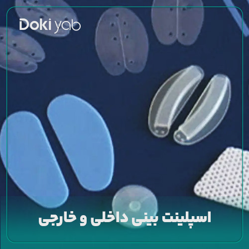 بررسی اینکه اسپلینت بینی چیست در مجله دکی یاب