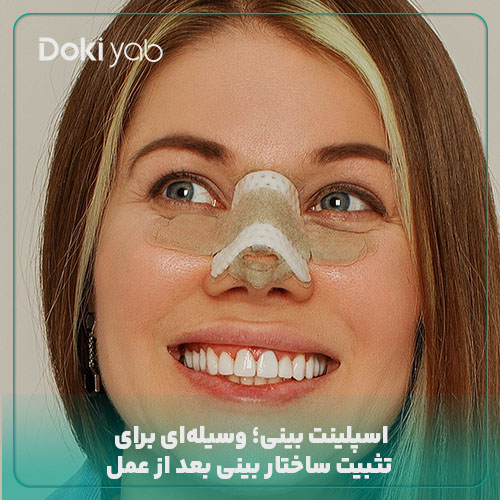 اسپلینت بینی چیست؟ وسیله‌ای برای تثبیت ساختار بینی بعد از عمل