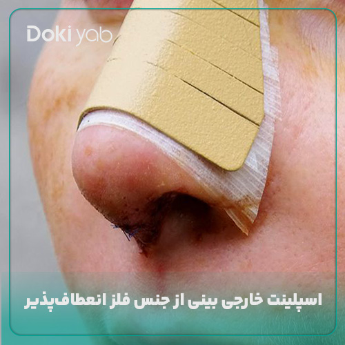 اسپلینت خارجی بینی از جنس فلز؛ مجله دکی یاب