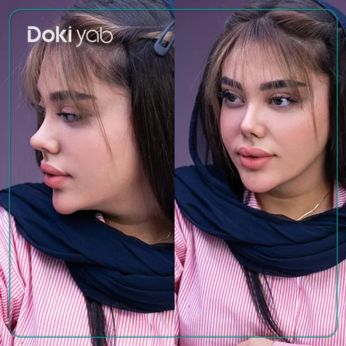 نتیجه مشاوره و انتخاب دکتر با دکی یاب؛ صفحه معرفی بهترین جراح بینی ترمیمی در شیراز