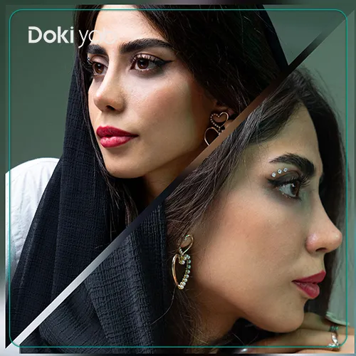 نمونه جراحی بینی استخوانی در دکی یاب؛ مقاله بررسی بهترین دکتر ترمیم بینی شیراز
