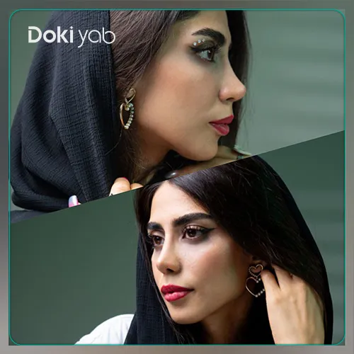 عمل بینی نیمه عروسکی شیراز در مجموعه دکی یاب
