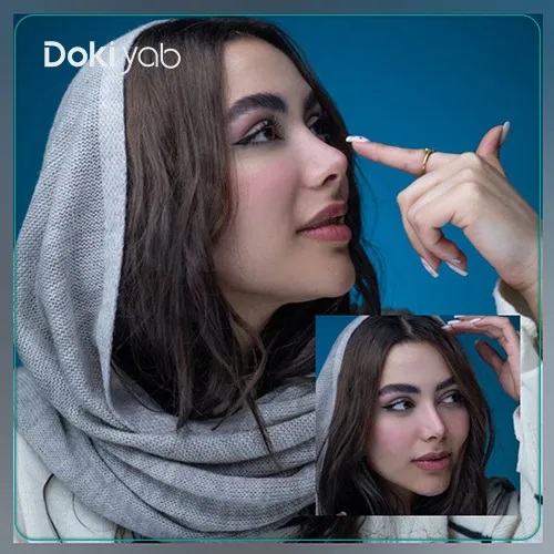 نمونه‌کار بهترین جراح بینی نیمه فانتزی در شیراز در مجموعه دکی یاب