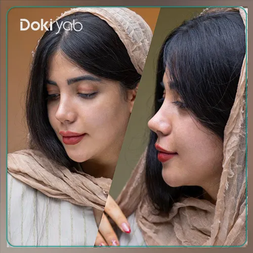 عمل بینی نیمه فانتزی در شیراز در مجموعه دکی یاب